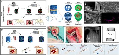 3D printing of bone and cartilage with polymer materials